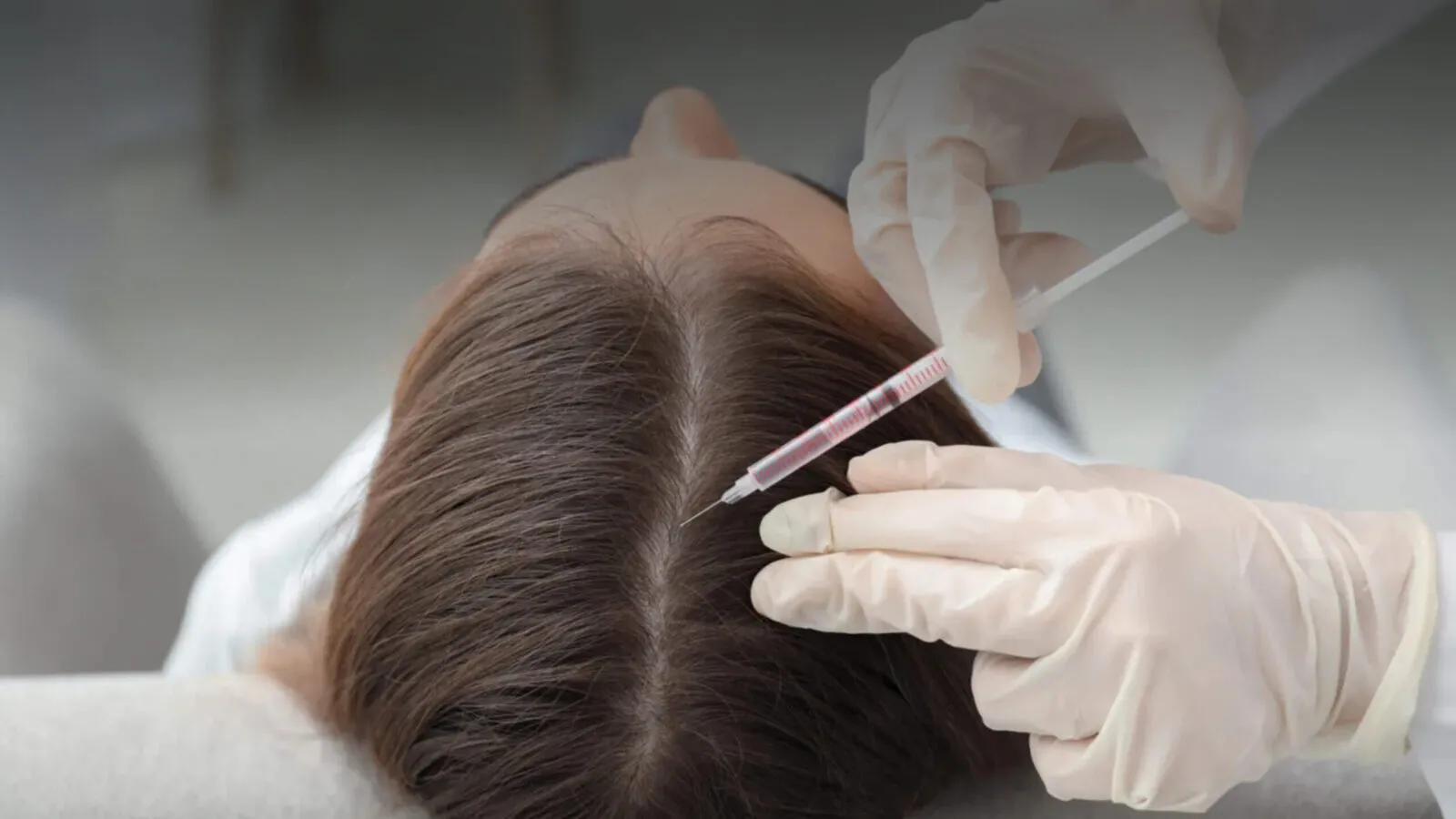 Trychoholistic - slider dobrze że tu jesteś Trycholog Łódź